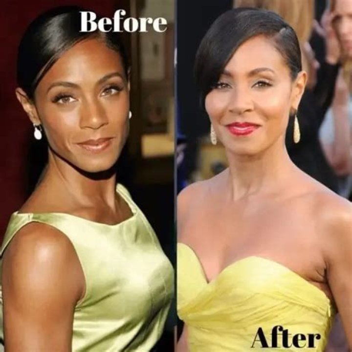 Jada Kingdom Bbl Surgery Update 2023 Before